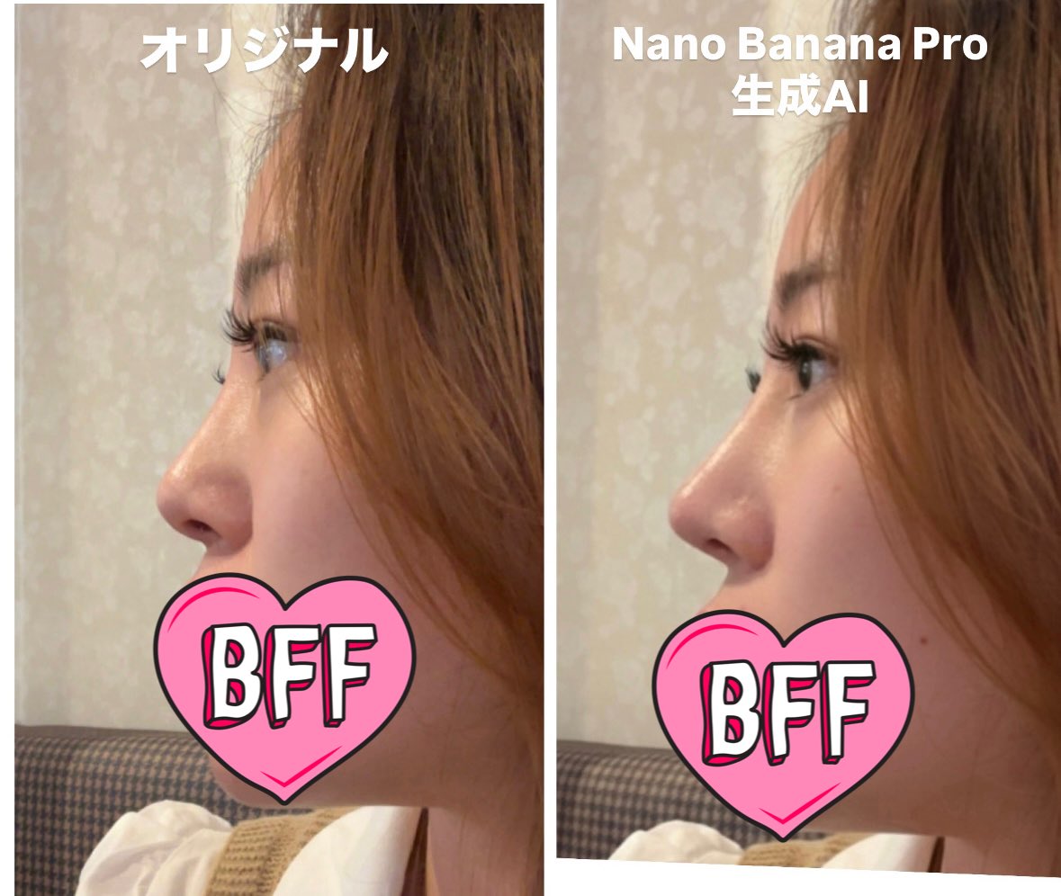 Generating Ideal Nose Shapes for Cosmetic Surgery Consultation 2